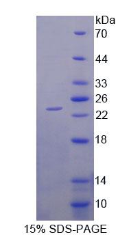 二肽酶2(DPEP2)重组蛋白,Recombinant Dipeptidase 2 (DPEP2)