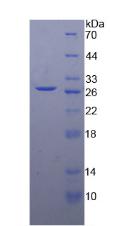 二酰甘油-O-酰基轉(zhuǎn)移酶同源物1(DGAT1)重組蛋白,Recombinant Diacylglycerol-O-Acyltransferase Homolog 1 (DGAT1)