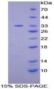 二酰甘油激酶ε(DGKe)重组蛋白,Recombinant Diacylglycerol Kinase Epsilon (DGKe)