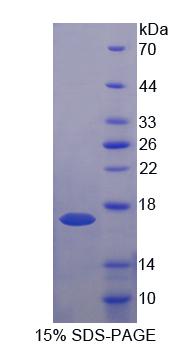 泛醇細(xì)胞色素C還原酶(UQCR)重組蛋白,Recombinant Ubiquinol Cytochrome C Reductase (UQCR)