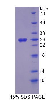 泛醌NADH脫氫酶Fe-S蛋白1(NDUFS1)重組蛋白,Recombinant NADH Dehydrogenase Ubiquinone Fe-S Protein 1 (NDUFS1)