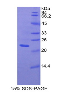 泛連接蛋白1(PANX1)重組蛋白,Recombinant Pannexin 1 (PANX1)