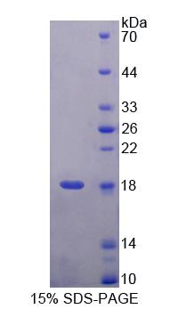 泛素A52残留核糖体蛋白融合产物1(UBA52)重组蛋白,Recombinant Ubiquitin A 52 Residue Ribosomal Protein Fusion Product 1 (UBA52)