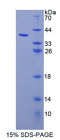 泛素关联蛋白1(UBAP1)重组蛋白,Recombinant Ubiquitin Associated Protein 1 (UBAP1)