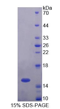 泛素关联蛋白2(UBAP2)重组蛋白,Recombinant Ubiquitin Associated Protein 2 (UBAP2)