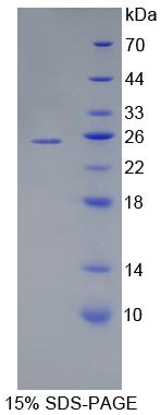 泛素结合酶E2C(UBE2C)重组蛋白,Recombinant Ubiquitin Conjugating Enzyme E2C (UBE2C)