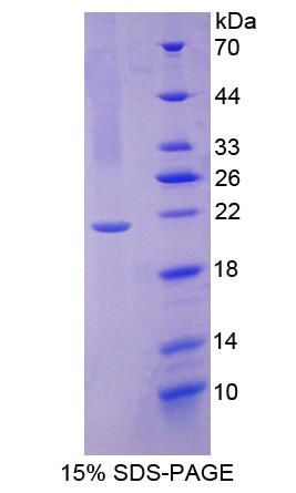 泛素结合酶E2C结合蛋白E2L3(UBE2L3)重组蛋白,Recombinant Ubiquitin Conjugating Enzyme E2L3 (UBE2L3)