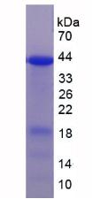 泛素连接酶E3A(UBE3A)重组蛋白,Recombinant Ubiquitin Protein Ligase E3A (UBE3A)