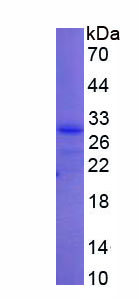 泛素羧基端酯酶L3(UCHL3)重组蛋白,Recombinant Ubiquitin Carboxyl Terminal Hydrolase L3 (UCHL3)