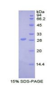 泛素羧基端酯酶L5(UCHL5)重组蛋白,Recombinant Ubiquitin Carboxyl Terminal Hydrolase L5 (UCHL5)