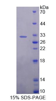 泛素特异性肽酶1(USP1)重组蛋白,Recombinant Ubiquitin Specific Peptidase 1 (USP1)