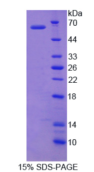 泛素特异性肽酶14(USP14)重组蛋白,Recombinant Ubiquitin Specific Peptidase 14 (USP14)