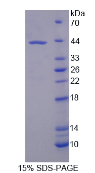 泛素特异性肽酶8(USP8)重组蛋白,Recombinant Ubiquitin Specific Peptidase 8 (USP8)