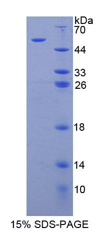 芳基硫酸酯酶B(ARSB)重组蛋白,Recombinant Arylsulfatase B (ARSB)