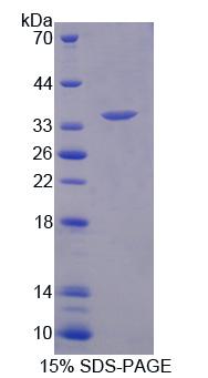 芳基硫酸酯酶F(ARSF)重组蛋白,Recombinant Arylsulfatase F (ARSF)