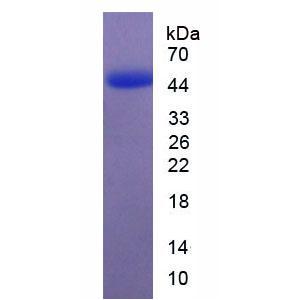 多巴胺受体D2(DRD2)重组蛋白,Recombinant Dopamine Receptor D2 (DRD2)