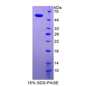 多配体蛋白聚糖1(SDC1)重组蛋白