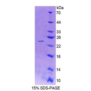 多配体蛋白聚糖4(SDC4)重组蛋白