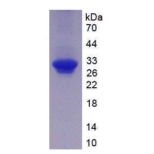 二肽基肽酶8(DPP8)重组蛋白