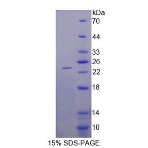 二肽酶2(DPEP2)重组蛋白,Recombinant Dipeptidase 2 (DPEP2)