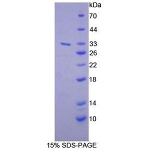 二酰甘油激酶γ(DGKg)重组蛋白,Recombinant Diacylglycerol Kinase Gamma (DGKg)