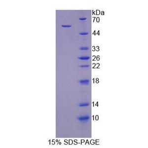 反式高尔基体网状结构蛋白2(TGOLN2)重组蛋白,Recombinant Trans Golgi Network Protein 2 (TGOLN2)