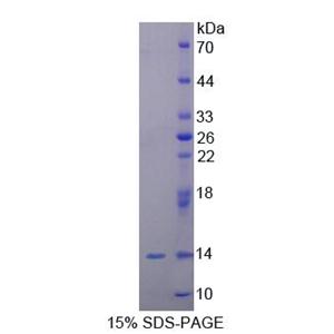 泛醌蛋白2(UBQLN2)重组蛋白,Recombinant Ubiquilin 2 (UBQLN2)