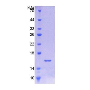 泛素激活酶样蛋白(UBE1L)重组蛋白,Recombinant Ubiquitin Activating Enzyme E1 Like Protein (UBE1L)