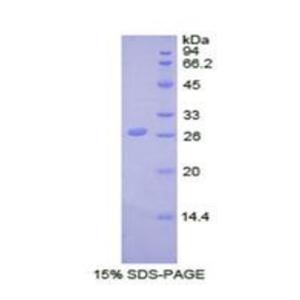 泛素羧基端酯酶L5(UCHL5)重组蛋白