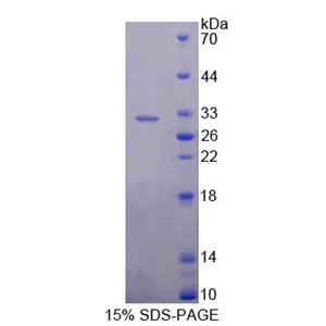 泛素特异性肽酶1(USP1)重组蛋白