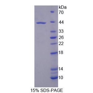 泛素特异性肽酶8(USP8)重组蛋白
