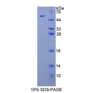 芳基硫酸酯酶B(ARSB)重组蛋白,Recombinant Arylsulfatase B (ARSB)