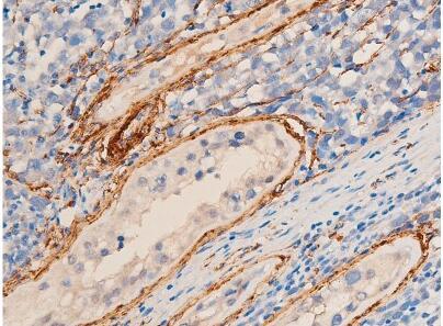 BDH1 antibody