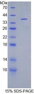 防御素β1(DEFb1)重组蛋白,Recombinant Defensin Beta 1 (DEFb1)