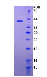 防御素β119(DEFb119)重組蛋白,Recombinant Defensin Beta 119 (DEFb119)