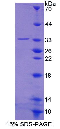 纺锤体蛋白1(SPIN1)重组蛋白,Recombinant Spindlin 1 (SPIN1)