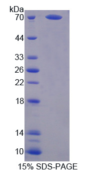 非ATP酶蛋白酶体26S亚基4(PSMD4)重组蛋白,Recombinant Proteasome 26S Subunit, Non ATPase 4 (PSMD4)