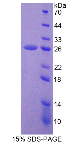 非ATP酶蛋白酶體26S亞基5(PSMD5)重組蛋白,Recombinant Proteasome 26S Subunit, Non ATPase 5 (PSMD5)