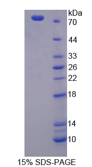 非ATP酶蛋白酶體26S亞基6(PSMD6)重組蛋白,Recombinant Proteasome 26S Subunit, Non ATPase 6 (PSMD6)