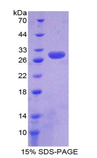 非ATP酶蛋白酶体26S亚基9(PSMD9)重组蛋白,Recombinant Proteasome 26S Subunit, Non ATPase 9 (PSMD9)