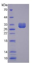非红细胞血影蛋白β4(SPTbN4)重组蛋白,Recombinant Spectrin Beta, Non Erythrocytic 4 (SPTbN4)