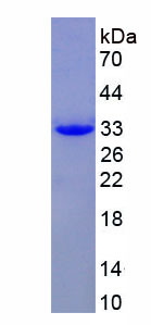 非受體酪氨酸激酶2(TNK2)重組蛋白,Recombinant Tyrosine Kinase, Non Receptor 2 (TNK2)