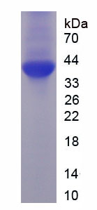 非受体型蛋白酪氨酸磷酸酶1(PTPN1)重组蛋白,Recombinant Protein Tyrosine Phosphatase, Non Receptor Type 1 (PTPN1)