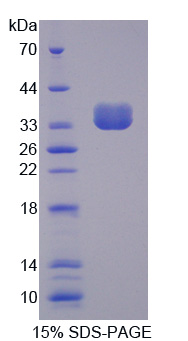 非受體型蛋白酪氨酸磷酸酶6(PTPN6)重組蛋白,Recombinant Protein Tyrosine Phosphatase, Non Receptor Type 6 (PTPN6)