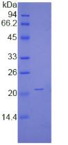 非轉(zhuǎn)移細(xì)胞1表達(dá)NM23A蛋白(NME1)重組蛋白,Recombinant Non Metastatic Cells 1, Protein NM23A Expressed In (NME1)