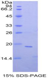 非转移细胞4表达NM23A蛋白(NME4)重组蛋白,Recombinant Non Metastatic Cells 4, Protein NM23A Expressed In (NME4)