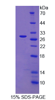 分拣连接蛋白13(SNX13)重组蛋白,Recombinant Sorting Nexin 13 (SNX13)