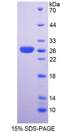 分拣连接蛋白关联高尔基蛋白1(SNAG1)重组蛋白,Recombinant Sorting Nexin Associated Golgi Protein 1 (SNAG1)