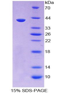 分泌球蛋白家族3A成员1(SCGB3A1)重组蛋白,Recombinant Secretoglobin Family 3A, Member 1 (SCGB3A1)