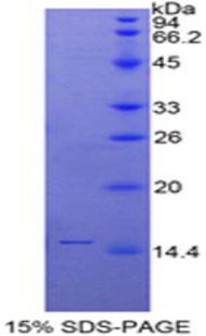 分泌型Ly6/uPAR相關(guān)蛋白1(SLURP1)重組蛋白,Recombinant Secreted Ly6/uPAR Related Protein 1 (SLURP1)